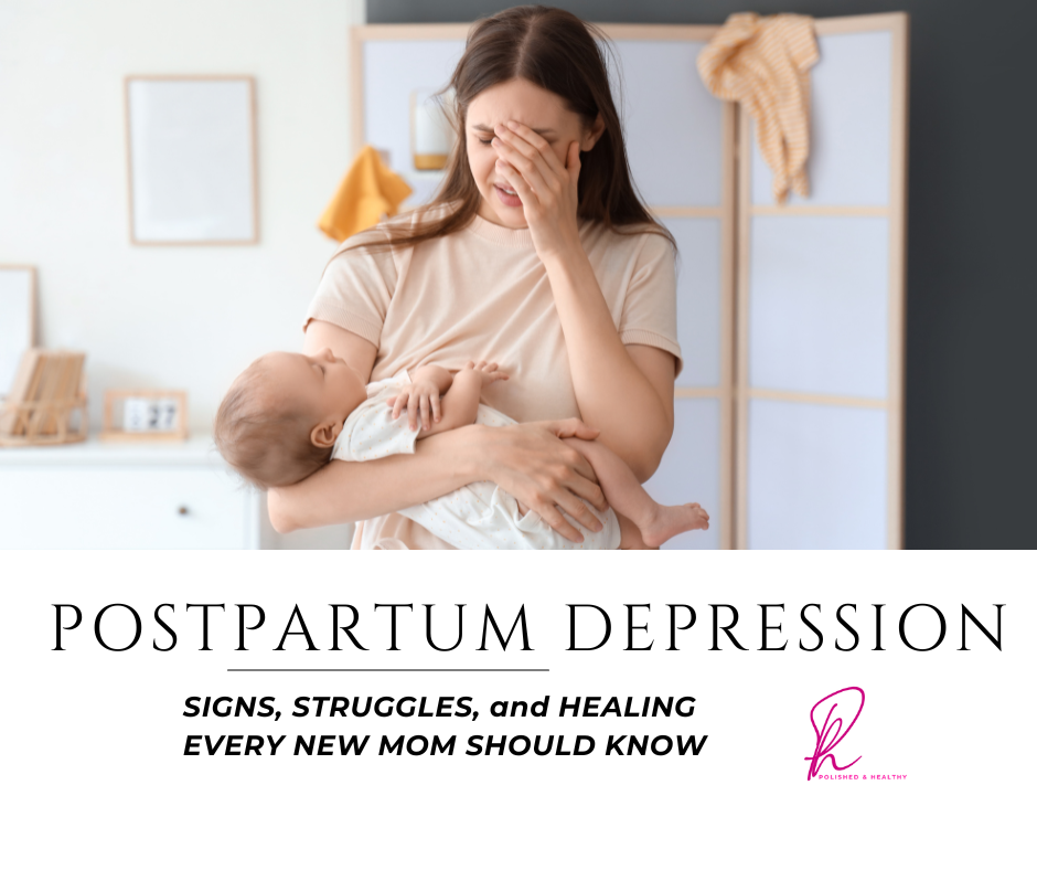 Postpartum Depression