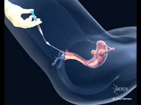 4db971e2 aae7 4338 b5b1 49e4c0ded9d5